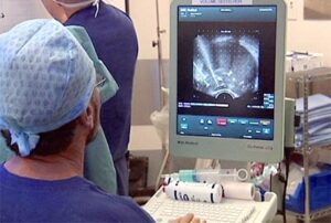 Focal Therapy for Prostate Cancer