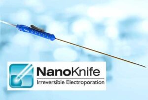 Nanoknife Training For US Urologists