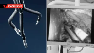 Channel 7 News Story On Single Port Robotic Surgery