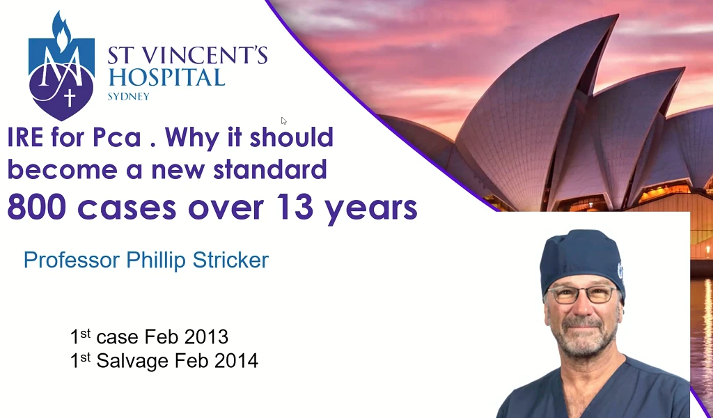 IRE Results Presented to the TUA